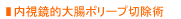 内視鏡的大腸ポリープ切除術