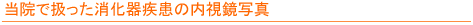当院で扱った消化器疾患の内視鏡写真