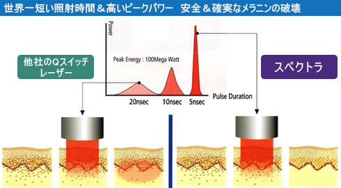 世界一短い照射時間＆高いピークパワー　安全＆確実なメラニンの破壊
