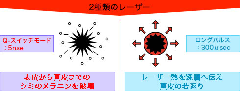 2種類のレーザー